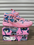 Adidas MB.03 x Kid Super Sz 11